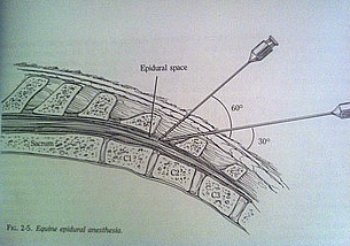 equine epidural - TSVS - Justin Harper, DVM